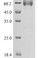 Human Protein mono-ADP-ribosyltransferase PARP14 (PARP14), partial Recombinant Protein, C-hFc1 - BioCrest Sci