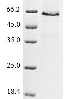 Mouse Long-chain-fatty-acid--CoA ligase 4 (Acsl4), partial Recombinant Protein - BioCrest Sci