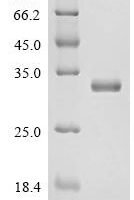 Human Peroxiredoxin-6（PRDX6) Recombinant Protein - BioCrest Sci