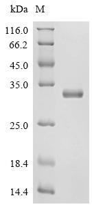 Human Peroxiredoxin-6(PRDX6) Recombinant Protein, Homo sapiens (Human), Mammalian cell, N-terminal 10xHis-tagged, 27.6 kDa, purity >≥ 95% as determined by SDS-PAGE.