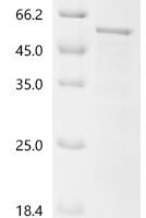 Human Myocyte-specific enhancer factor 2C (MEF2C) Recombinant Protein - BioCrest Sci