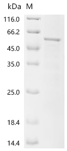 Human Myocyte-specific enhancer factor 2C (MEF2C) Recombinant Protein, Homo sapiens (Human), E.coli, C-terminal Flag-tagged, 52.4 kDa, purity >≥ 85% as determined by SDS-PAGE.