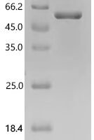 Pongo abelii Dyslexia-associated protein KIAA0319-like protein (KIAA0319L), partial Recombinant Protein, C-His, aa 310–785, E.coli - BioCrest Sci