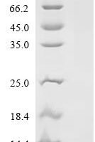Mouse Secreted Ly-6/uPAR domain-containing protein 2 (Slurp2) Recombinant Protein - BioCrest Sci