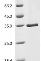 Mouse Osteoclast-stimulating factor 1 (Ostf1) Recombinant Protein - BioCrest Sci