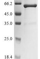 Chicken Lysozyme C (LYZ),Biotinylated Recombinant Protein - BioCrest Sci