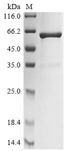 Chicken Lysozyme C (LYZ),Biotinylated Recombinant Protein, Gallus gallus (Chicken), E.coli, N-terminal MBP-tagged and C-terminal 6xHis-Avi-tagged, 62.1 kDa, purity >≥ 85% as determined by SDS-PAGE.