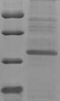 Human Protein S100-A7A (S100A7A), partial Recombinant Protein - BioCrest Sci