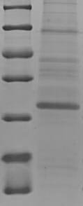 Human Protein S100-A7A (S100A7A), partial Recombinant Protein, Homo sapiens (Human), E.coli, N-terminal 6xHis-SUMO-tagged, 27.2 kDa, purity >≥ 90% as determined by SDS-PAGE.