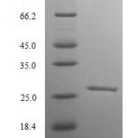 Rat Retinoblastoma-associated protein (Rb1), partial Recombinant Protein - BioCrest Sci