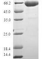 Human Alcohol dehydrogenase 1C (ADH1C) Recombinant Protein, N-GST - BioCrest Sci