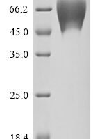 Human Trophoblast glycoprotein (TPBG), partial Recombinant Protein - BioCrest Sci