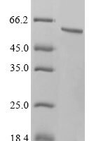 Human Tryptophan--tRNA ligase, cytoplasmic (WARS1) Recombinant Protein - BioCrest Sci