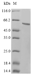 Human Tryptophan--tRNA ligase, cytoplasmic (WARS1) Recombinant Protein, Homo sapiens (Human), Mammalian cell, N-terminal 10xHis-tagged, 56.7 kDa, purity >≥ 90% as determined by SDS-PAGE.