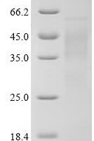 Rat Beta-nerve growth factor (Ngf) Recombinant Protein, C-10His - BioCrest Sci