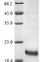 Mouse IGF-like family receptor 1 (Igflr1), partial Recombinant Protein, N-His - BioCrest Sci