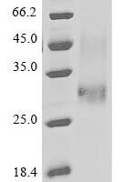Pongo abelii Lysosome-associated membrane glycoprotein 5 (LAMP5), partial Recombinant Protein, N-His - BioCrest Sci