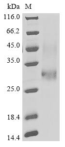 Pongo abelii Lysosome-associated membrane glycoprotein 5 (LAMP5), partial Recombinant Protein, N-His, Pongo abelii (Sumatran orangutan) (Pongo pygmaeus abelii), Yeast, N-terminal 6xHis-tagged, 25 kDa, purity >≥ 85% as determined by SDS-PAGE.