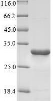 Rat 3-hydroxyacyl-CoA dehydrogenase type-2 (Hsd17b10) Recombinant Protein - BioCrest Sci