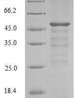 Mouse SET domain-containing protein 4 (Setd4) Recombinant Protein - BioCrest Sci