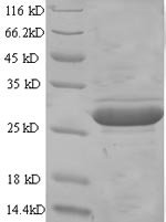 Mouse Glypican-4 (Gpc4), partial Recombinant Protein, N-GST, aa 530–557, Yeast - BioCrest Sci