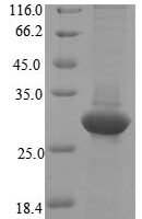 Ceratopteris richardii Cyanovirin-N homolog Recombinant Protein, N-10His-SUMO - BioCrest Sci
