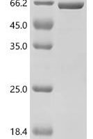 Mouse Major vault protein (Mvp), partial Recombinant Protein, C-His, aa 385–861 - BioCrest Sci