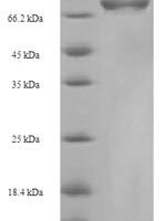 Mouse Cysteine sulfinic acid decarboxylase (Csad) Recombinant Protein - BioCrest Sci