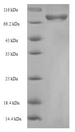 Mouse Cysteine sulfinic acid decarboxylase (Csad) Recombinant Protein, Mus musculus (Mouse), E.coli, N-terminal 6xHis-SUMO-tagged, 71.1 kDa, purity >≥ 90% as determined by SDS-PAGE.