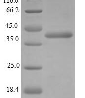 Mouse Serine protease 29 (Prss29) Recombinant Protein, N-His-B2M - BioCrest Sci