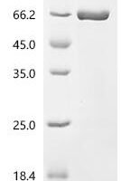 BK polyomavirus Small t antigen, Biotinylated Recombinant Protein - BioCrest Sci