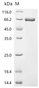 BK polyomavirus Small t antigen, Biotinylated Recombinant Protein, BK polyomavirus (strain AS) (BKPyV), E.coli, N-terminal MBP-tagged and C-terminal 6xHis-Avi-tagged, 68.2 kDa, purity >≥ 90% as determined by SDS-PAGE.