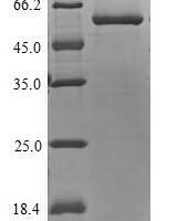 Human UDP-glucuronosyltransferase 1A4 (UGT1A4) Recombinant Protein - BioCrest Sci