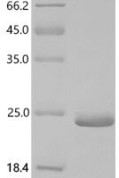 Human 3-ketoacyl-CoA thiolase, peroxisomal (ACAA1), partial Recombinant Protein - BioCrest Sci