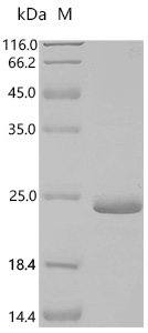 Human 3-ketoacyl-CoA thiolase, peroxisomal (ACAA1), partial Recombinant Protein, Homo sapiens (Human), E.coli, C-terminal 6xHis-tagged, 20.7 kDa, purity >≥ 95% as determined by SDS-PAGE.