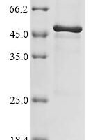 Mycoplasma genitalium Uncharacterized protein MG281 (MG281), partial Recombinant Protein, N-His - BioCrest Sci