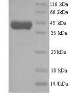 Human Methionine synthase (MTR), partial Recombinant Protein, N-His - BioCrest Sci