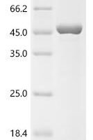 Human Formin-2 (FMN2), partial Recombinant Protein, N-10His/C-Myc - BioCrest Sci