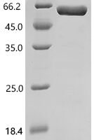 Human Nectin-4 (NECTIN4), partial, Biotinylated Recombinant Protein - BioCrest Sci