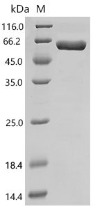 Human Nectin-4 (NECTIN4), partial, Biotinylated Recombinant Protein, Homo sapiens (Human), E.coli, N-terminal MBP-tagged and C-terminal 6xHis-Avi-tagged, 59.3 kDa, purity >≥ 85% as determined by SDS-PAGE.