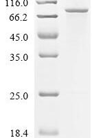 Drosophila melanogaster Protein bicaudal C (BicC), partial Recombinant Protein - BioCrest Sci