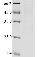 Human Gamma-secretase subunit APH-1A (APH1A), partial Recombinant Protein, N-10His/C-Myc - BioCrest Sci