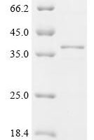 Mouse Deoxyribonuclease gamma (Dnase1l3), partial Recombinant Protein - BioCrest Sci