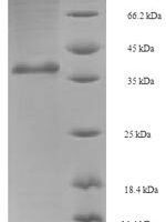 Saccharomyces cerevisiae GTP-binding nuclear protein GSP1/CNR1 (GSP1) Recombinant Protein - BioCrest Sci