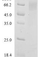 Rotavirus A Outer capsid glycoprotein VP7 Recombinant Protein, N-His-SUMOstar - BioCrest Sci