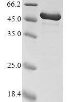 Cricetulus griseus Calreticulin (CALR) Recombinant Protein - BioCrest Sci