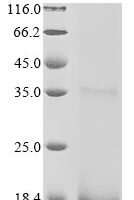 Human Protein FAM72A (FAM72A) Recombinant Protein - BioCrest Sci