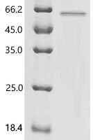 Human Krueppel-like factor 5 (KLF5) Recombinant Protein - BioCrest Sci