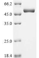 Human Calreticulin (CALR) Recombinant Protein, N-10His/C-Flag, aa 18–417, Mammalian cell - BioCrest Sci