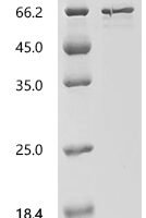 Human Pyruvate dehydrogenase E1 component subunit alpha, somatic form, mitochondrial (PDHA1), partial Recombinant Protein, N-His-SUMO - BioCrest Sci